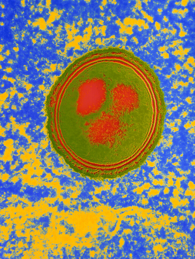 TEM of BCG vaccine in human blood cell