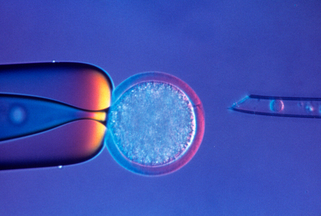 LM of egg and udder cell during sheep cloning