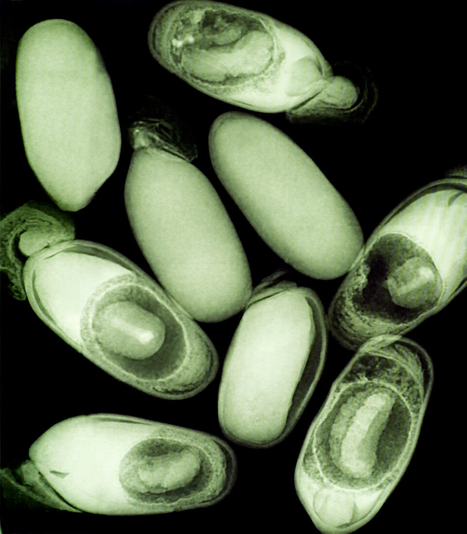Seed contamination,X-ray