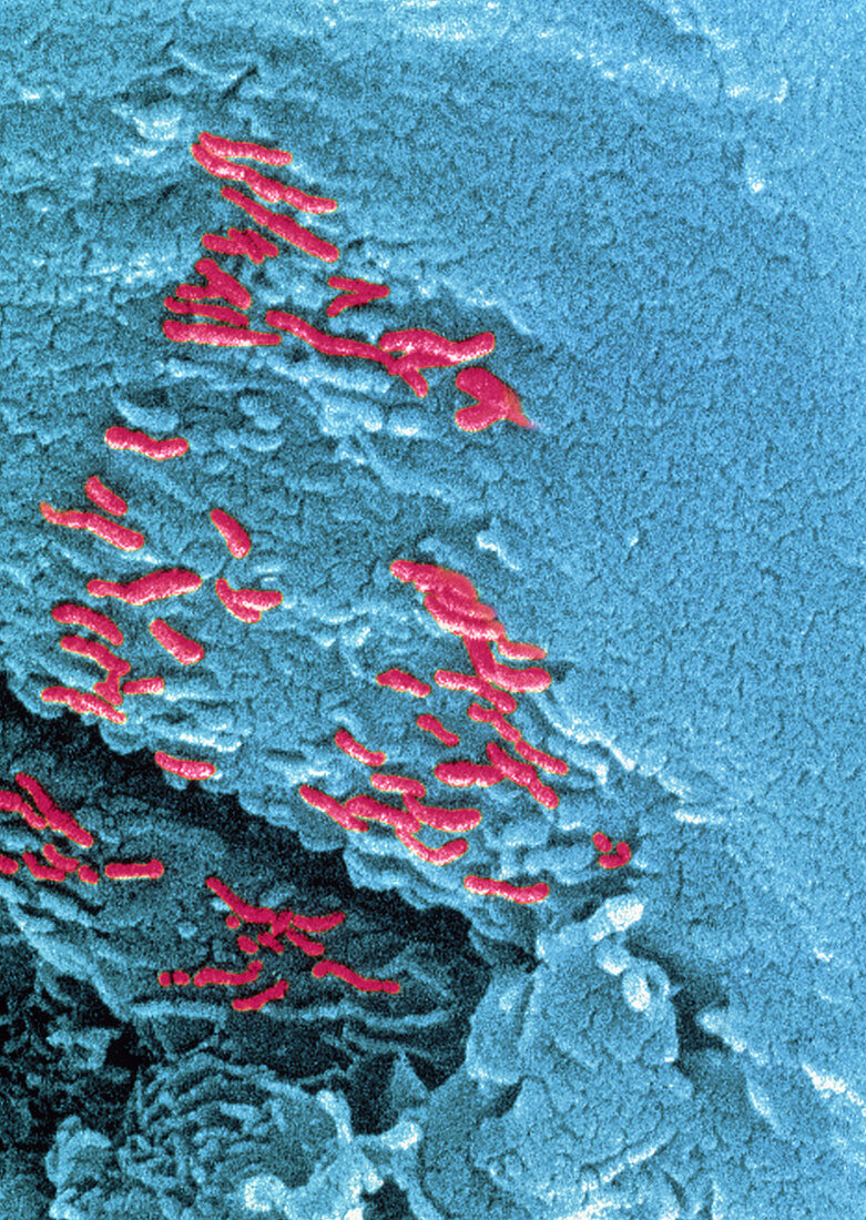 Colour electron micrograph of Martian microfossils