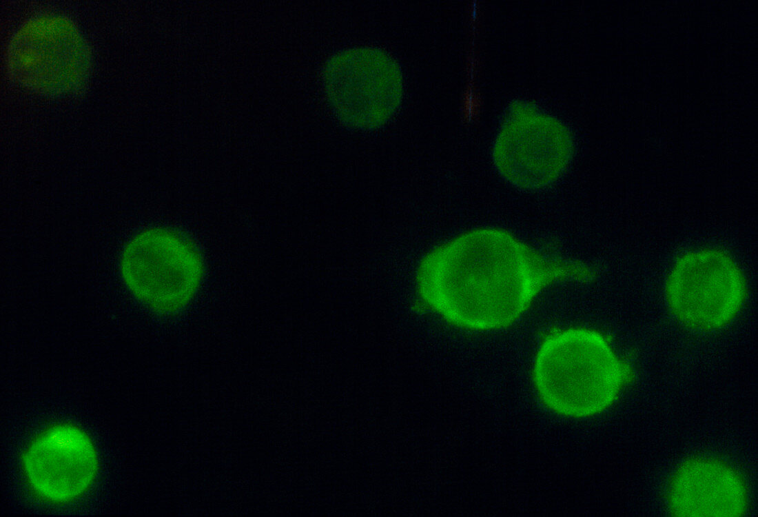 Fluorescence micrograph human monclonal antibodies