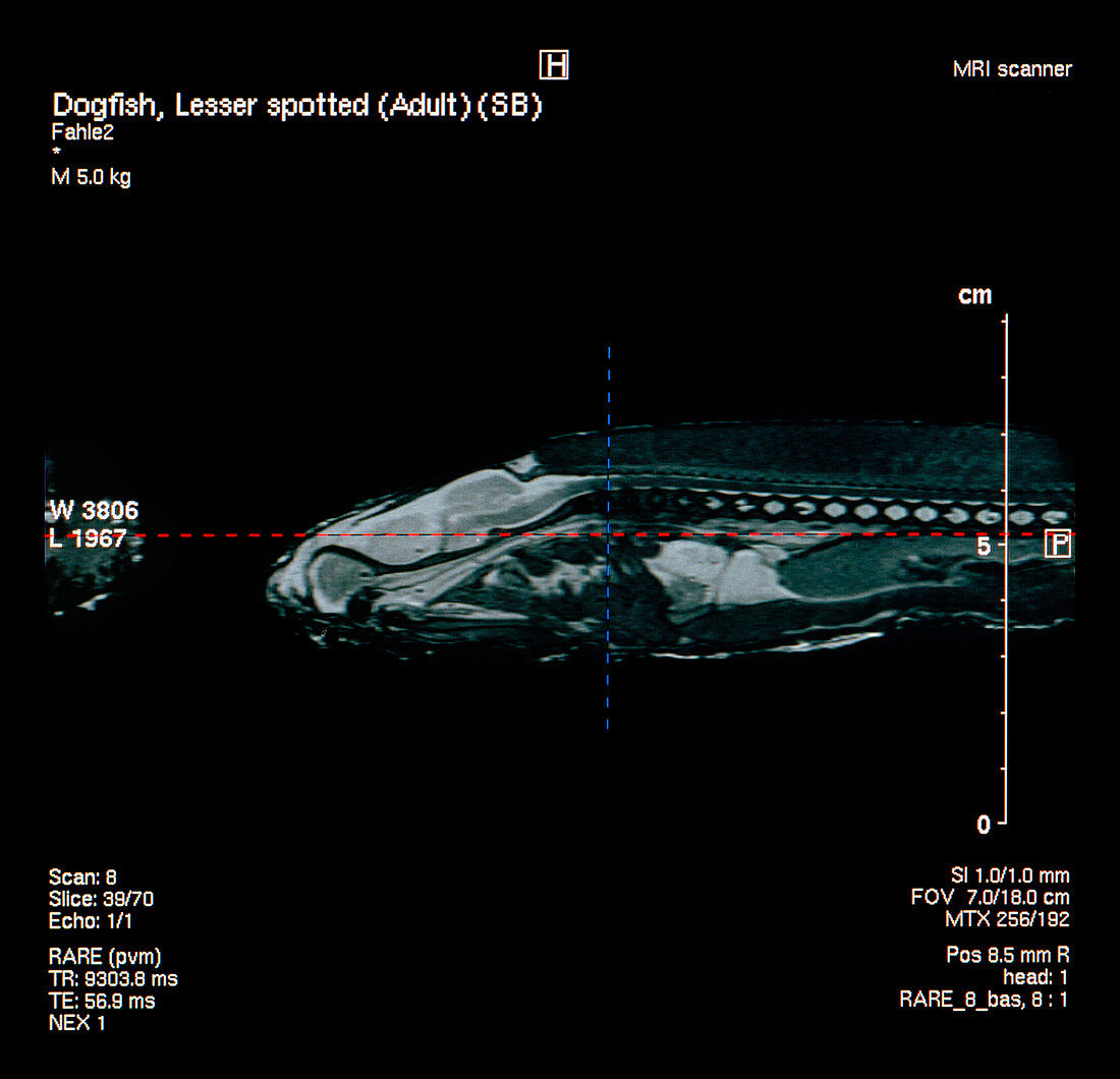 Dogfish jaw,MRI