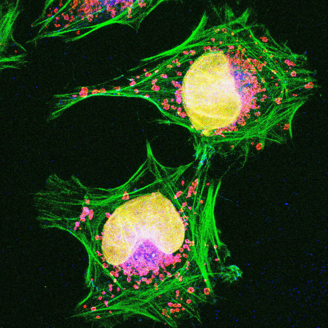 HeLa cells,light micrograph