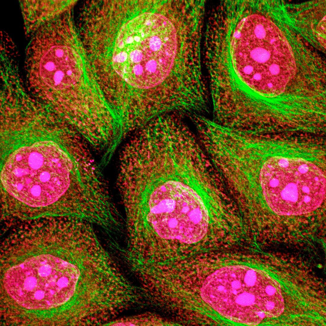 HeLa cells,light micrograph