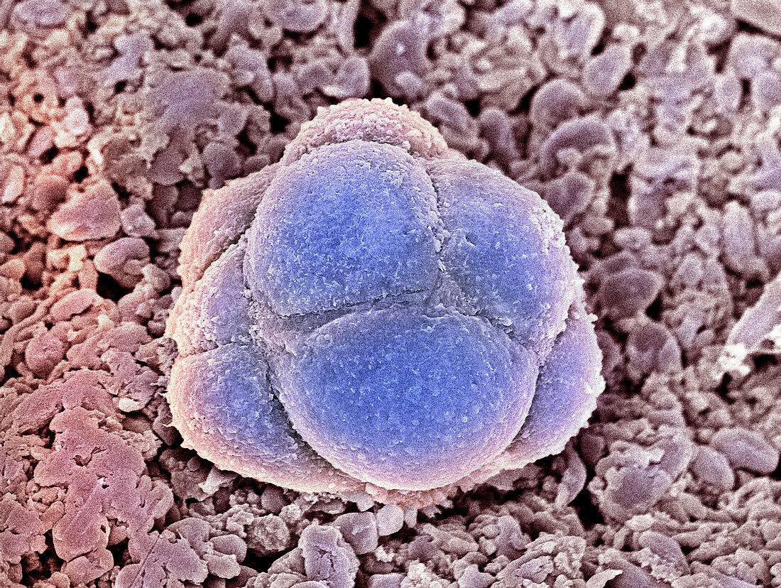 Stem cells,SEM