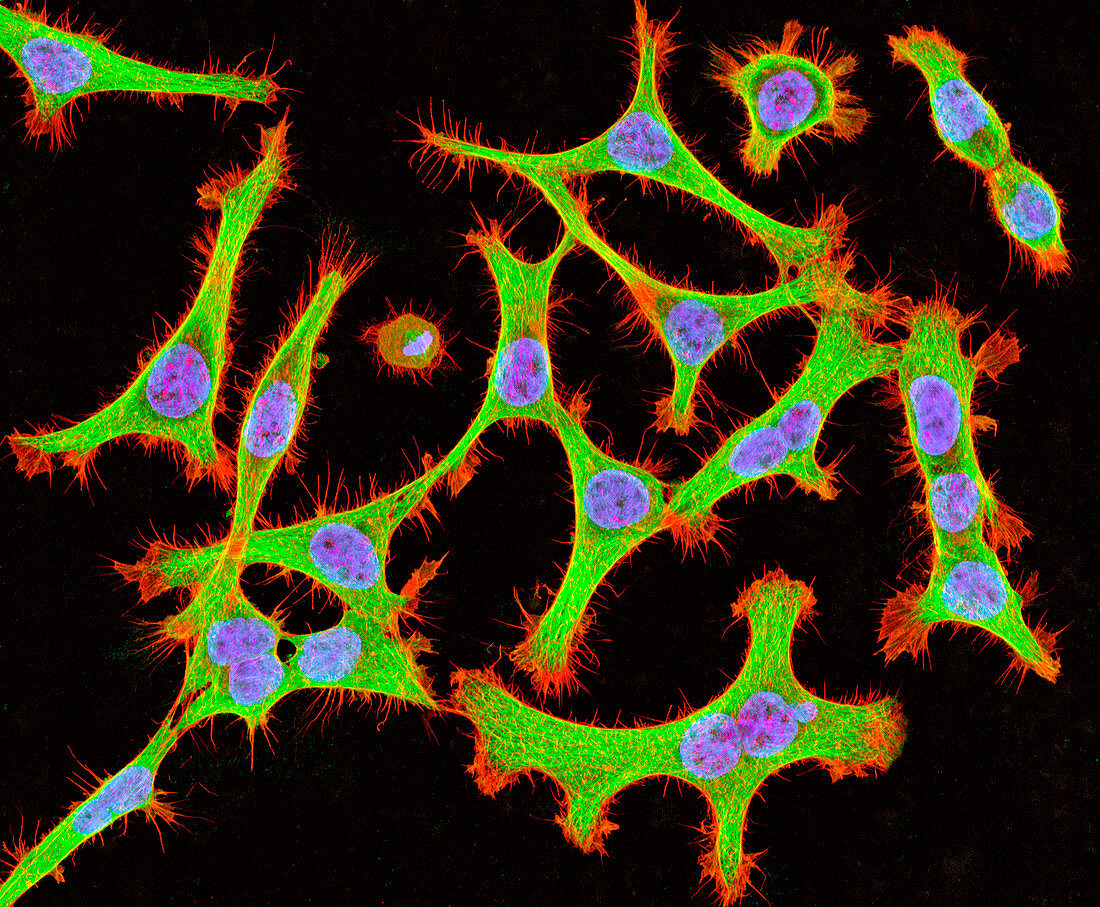 Cultured HeLa cells,light micrograph