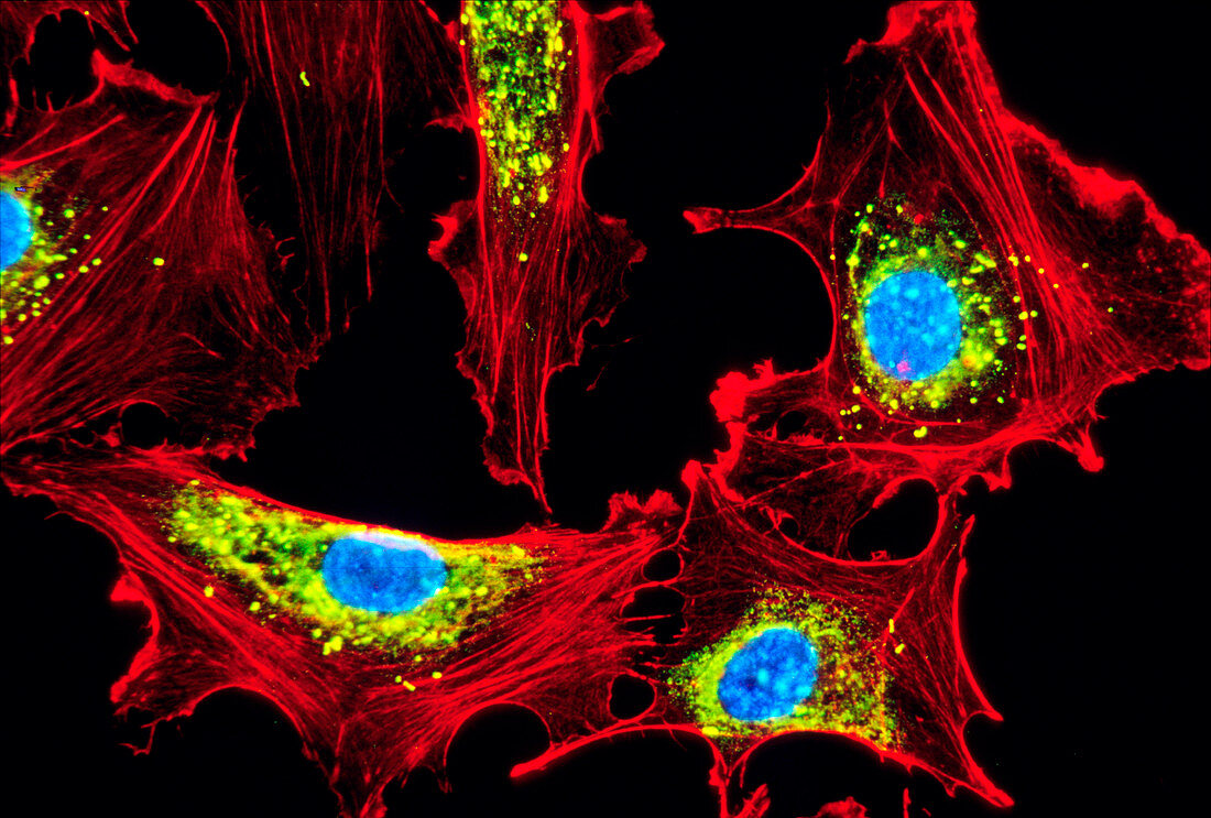 Human endothelial cells,light micrograph