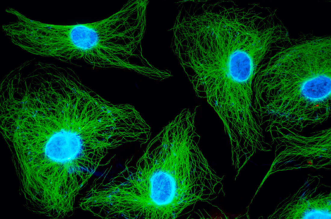 Human endothelial cells,light micrograph