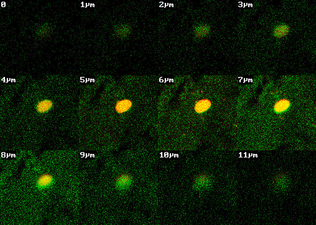 Monkey brains,stem cell research