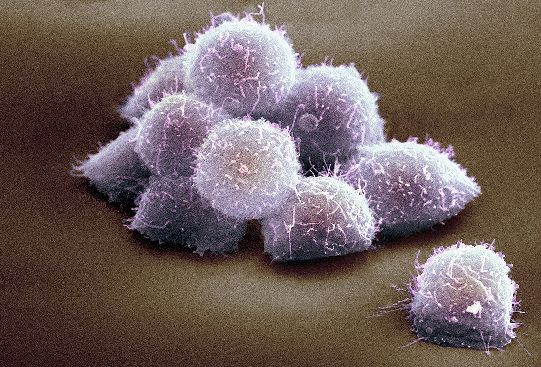 Stem cells,SEM