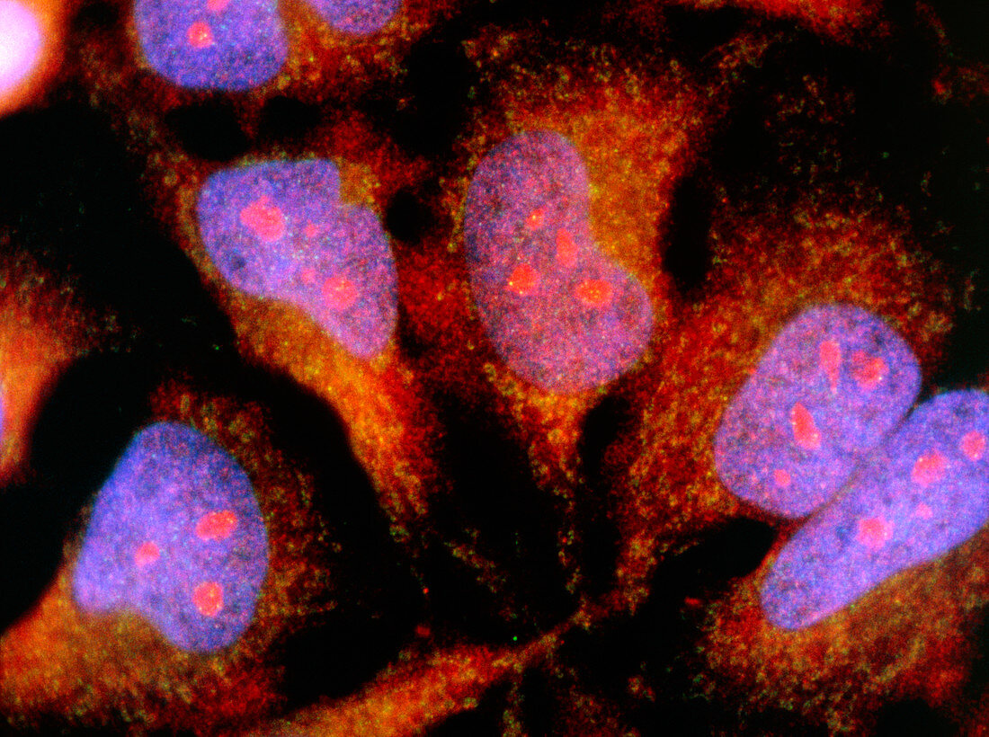 Immunofluorescent LM of HeLa cancer cell culture