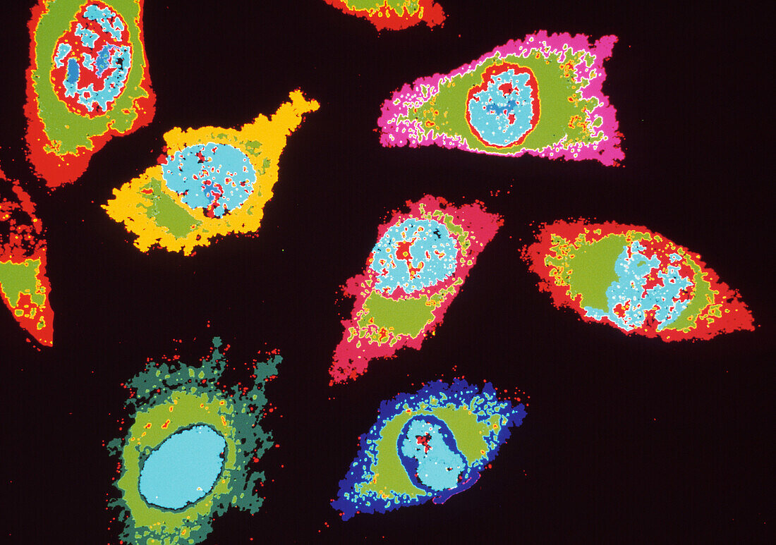 Coloured LM of HeLa cancer cells