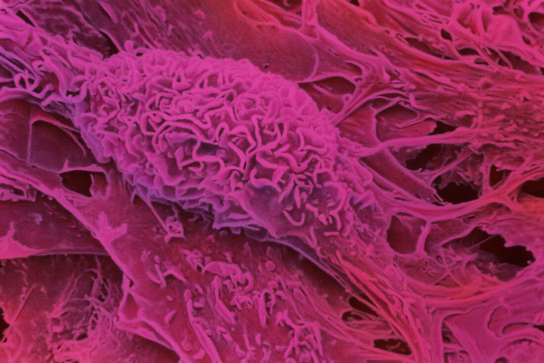 SEM of cultured embryonic stem cells