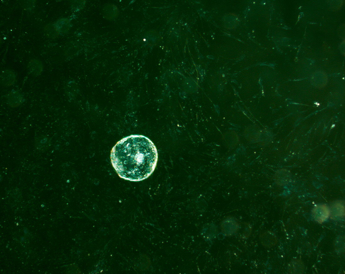 Human blastocyst,light micrograph