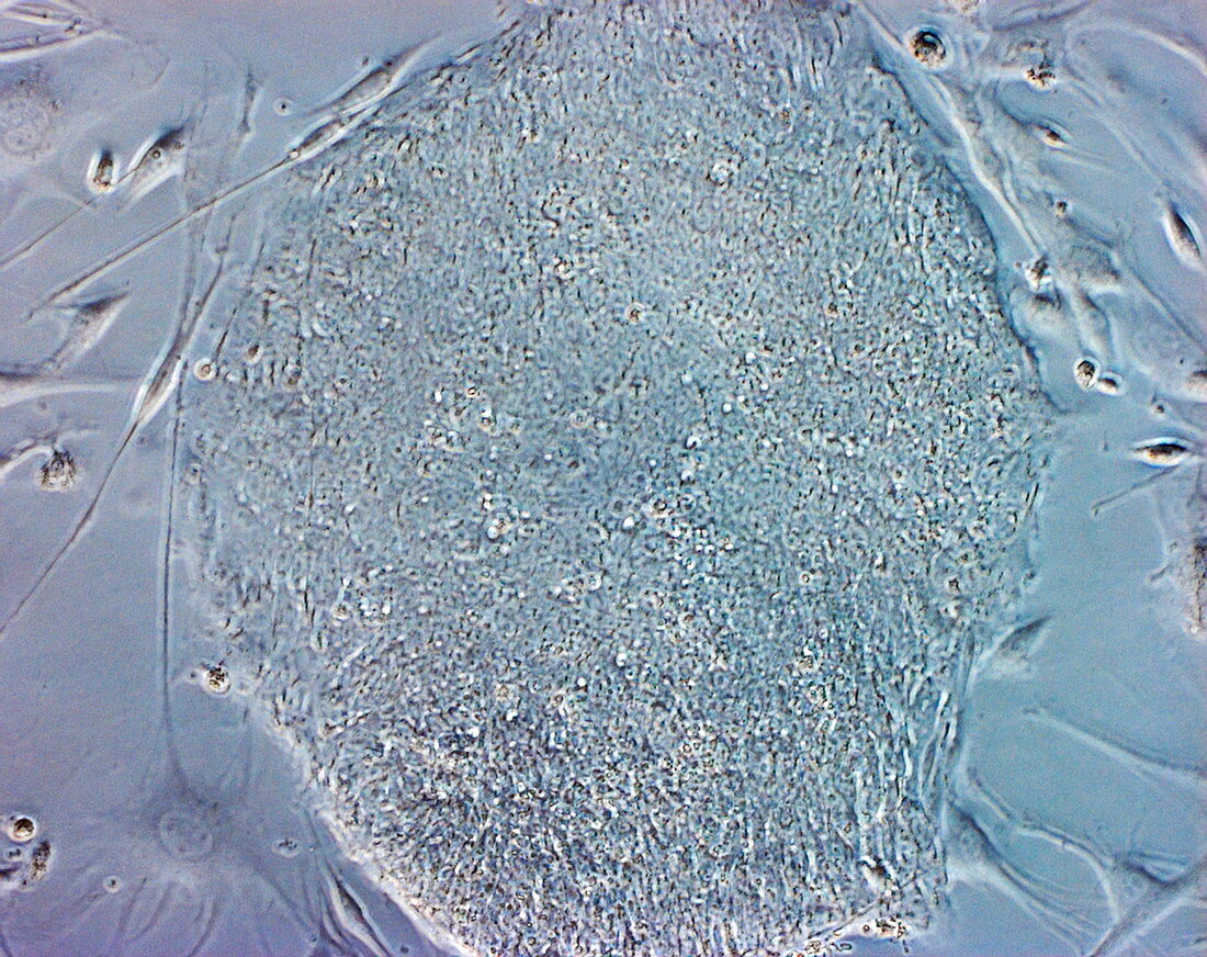 Stem cells,light micrograph