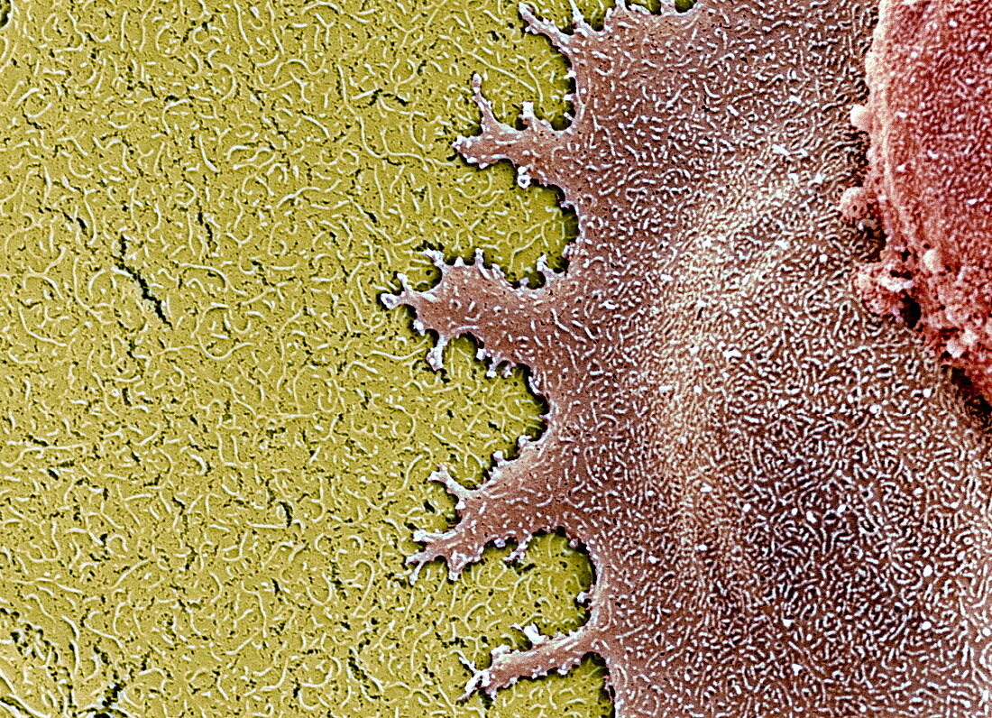 Stem cells,SEM