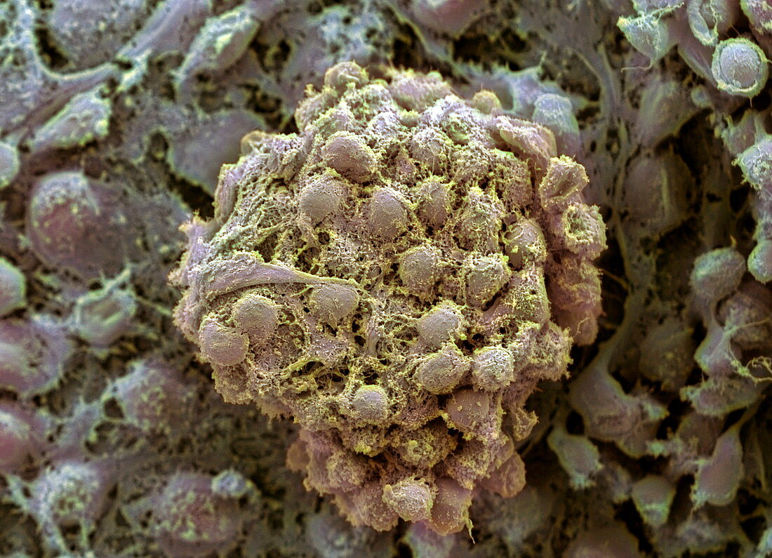 Embryonic stem cells,SEM