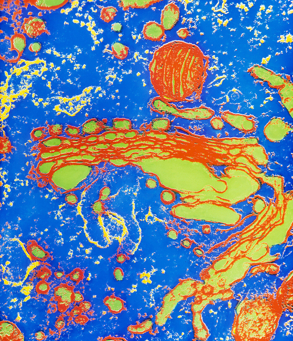Coloured TEM of a dictyosome in a Golgi apparatus