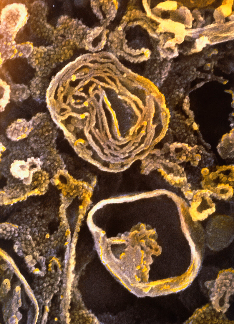 Coloured SEM of lysosomes in pancreas cell