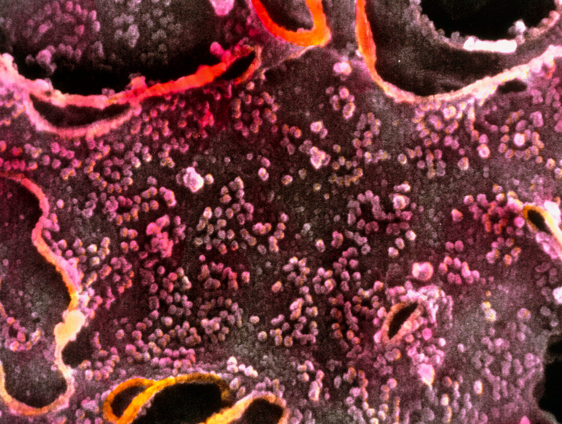 Coloured SEM of rough endoplasmic reticulum