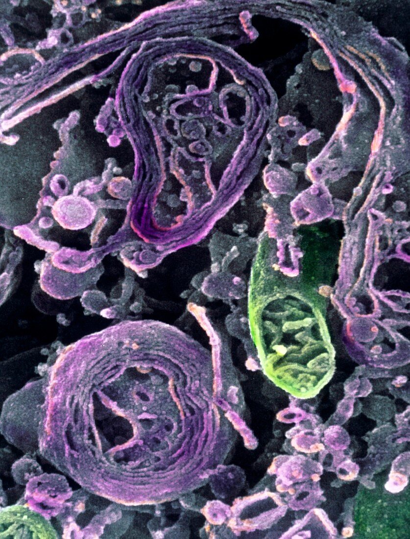 Coloured SEM of lysosomes in intestinal cell