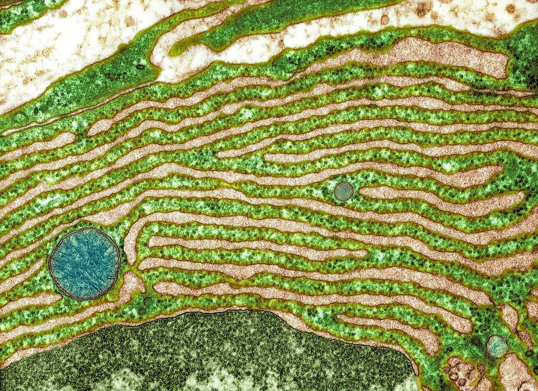Rough endoplasmic reticulum,TEM