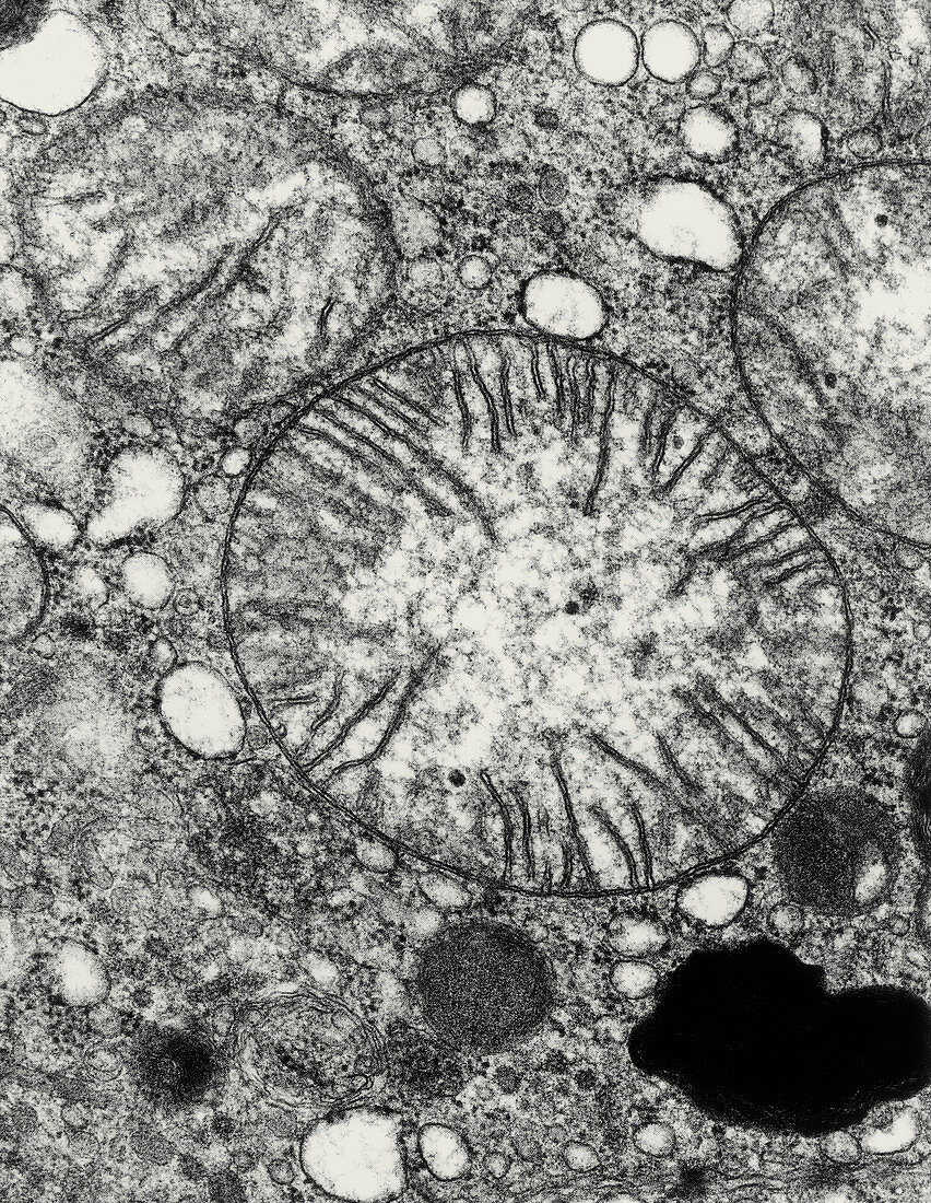 Transmission electron micrograph of mitochondria