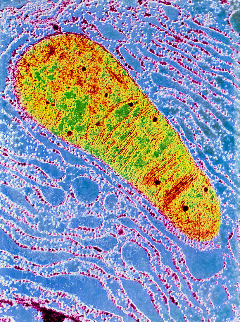 Colour TEM of mitochondrion,endoplasmic reticulum