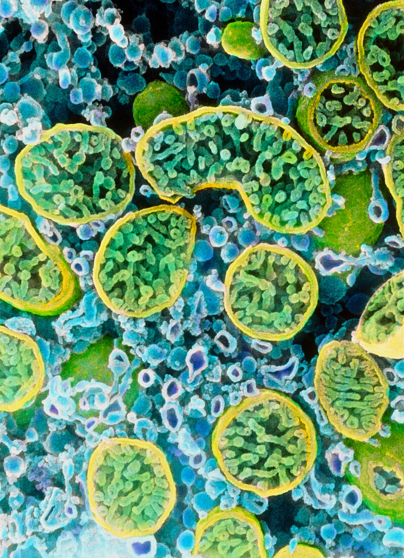 Coloured SEM of mitochondria in ovarian cells