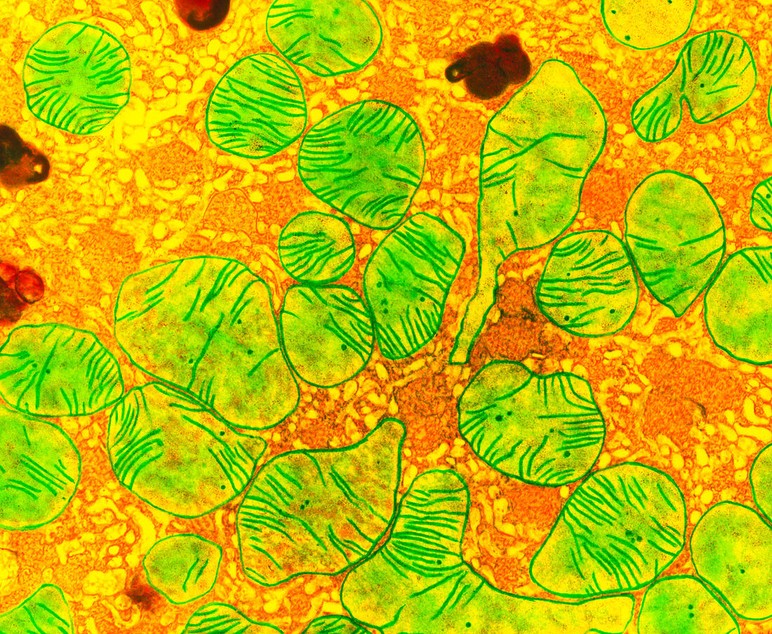 Coloured TEM of mitochondria from a kidney cell