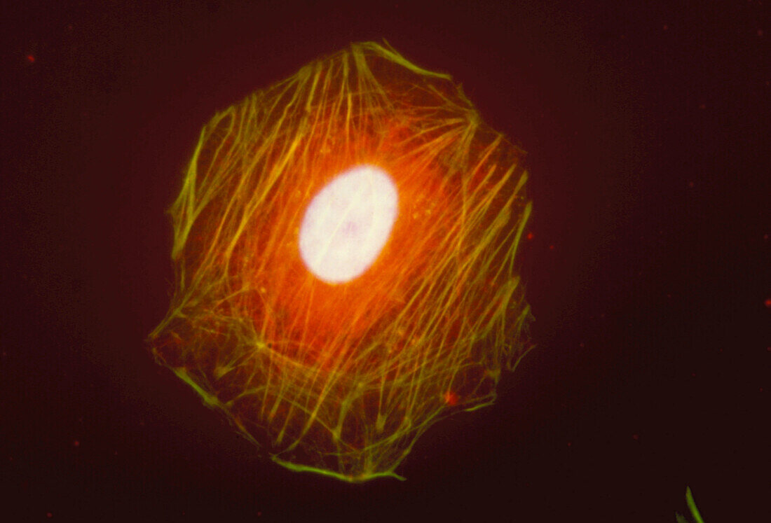 Immunofluorescent LM of the cytoskeleton of a cell