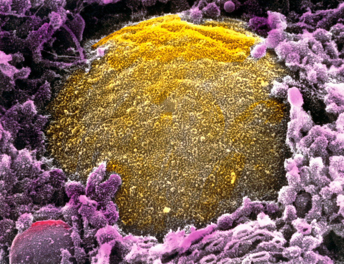 Coloured SEM of outer surface of nuclear membrane