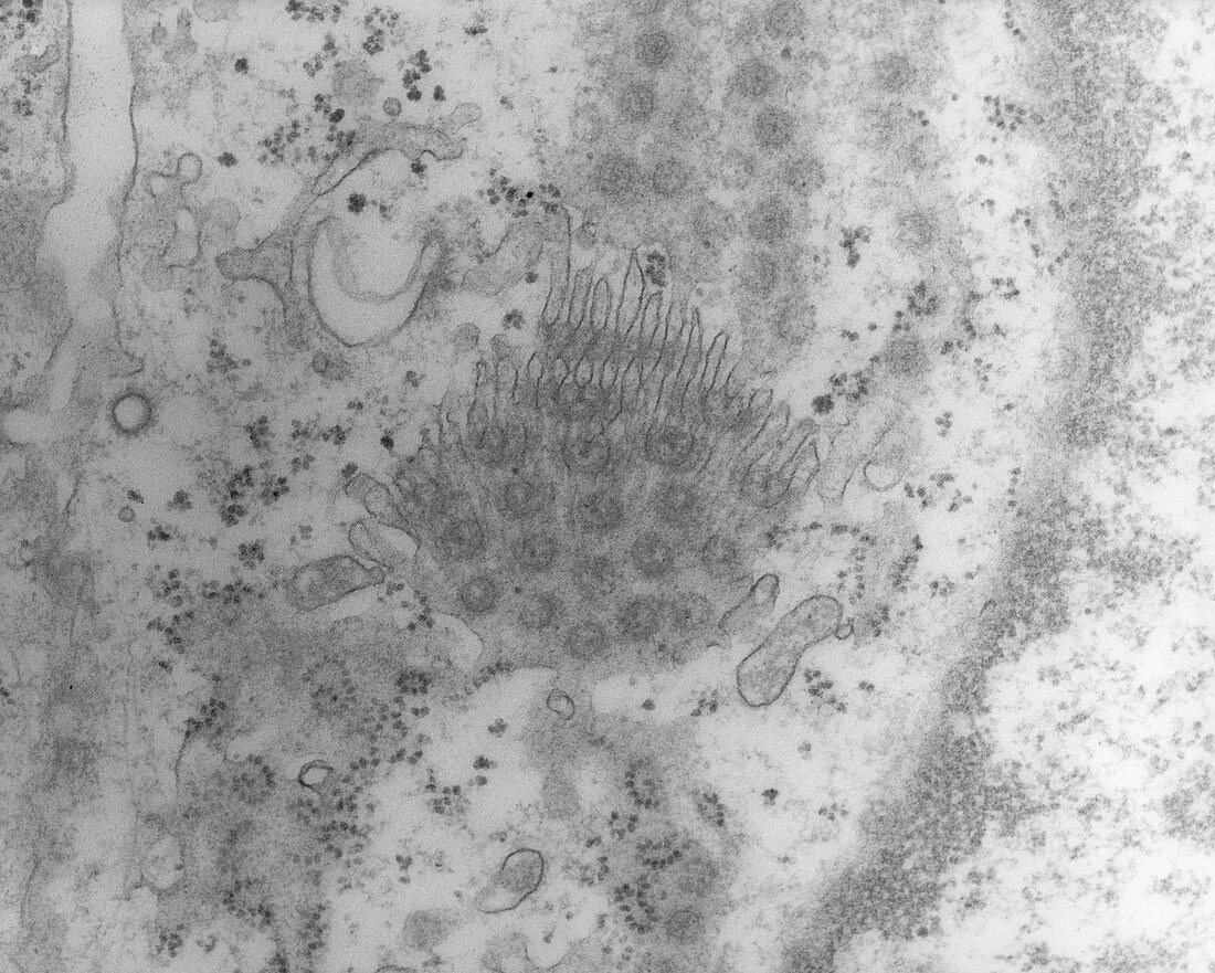 TEM of a cell nucleus membrane showing pores