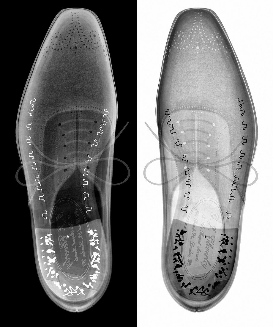 Man's shoes,X-ray