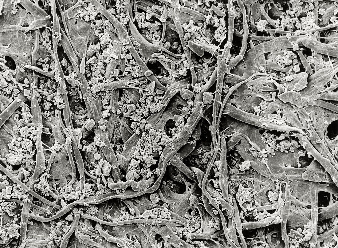 SEM of filter paper clogged with soil particles