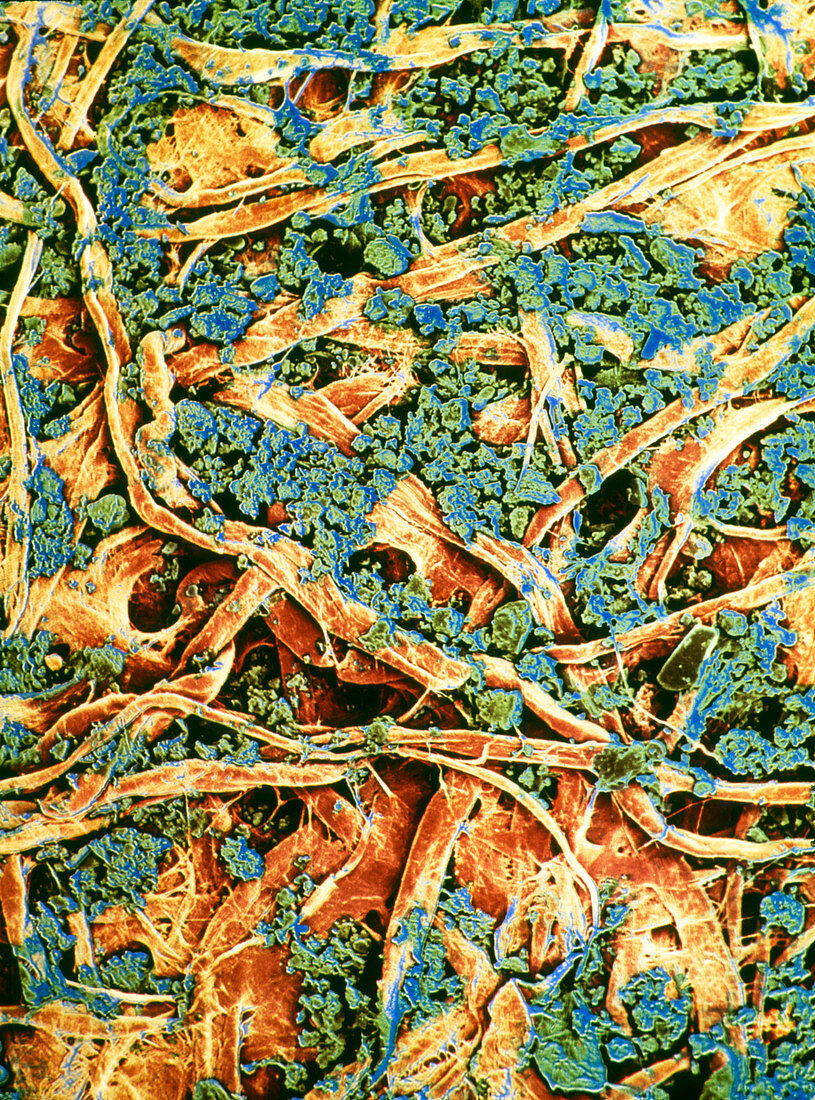 False-colour SEM of dirty filter paper