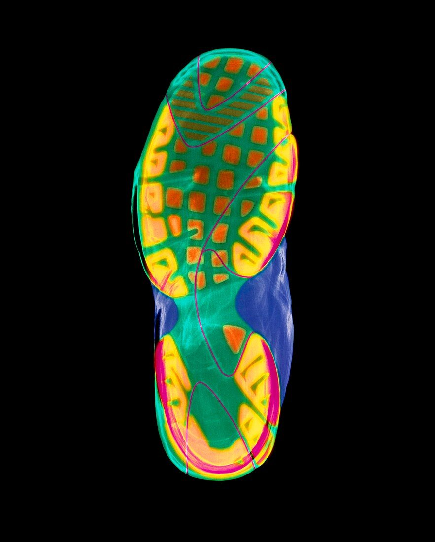 Coloured X-ray of the sole of a trainer shoe
