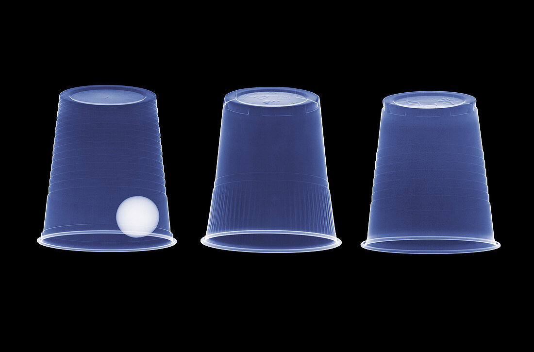 Cups and ball trick,X-ray