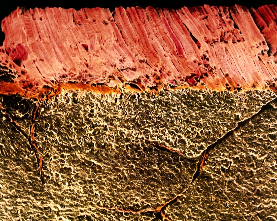 Coloured SEM of roast beef showing muscle fibres