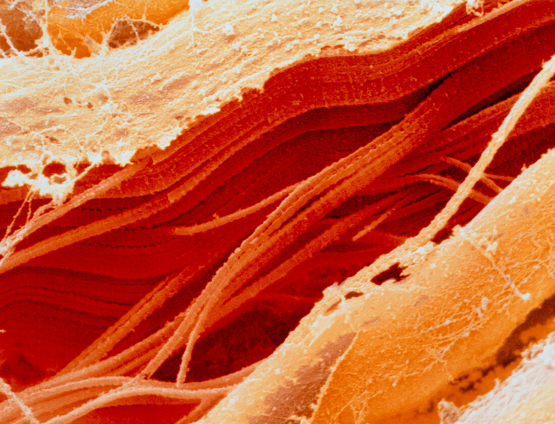 Coloured SEM of section through raw meat