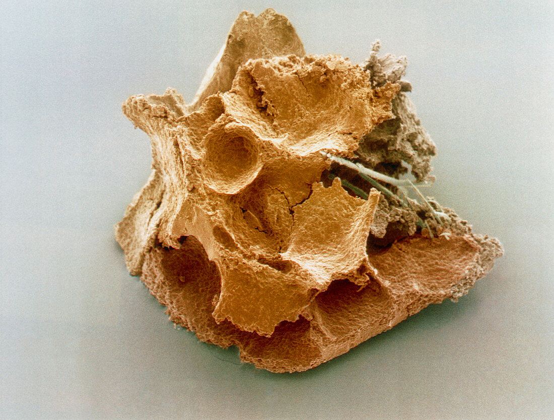 Coloured SEM of a single bread crumb