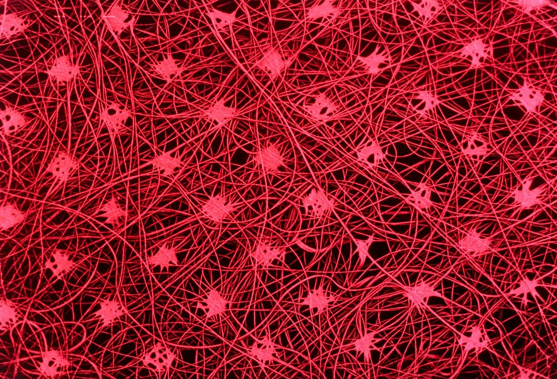 Tinted SEM of polypropene filaments