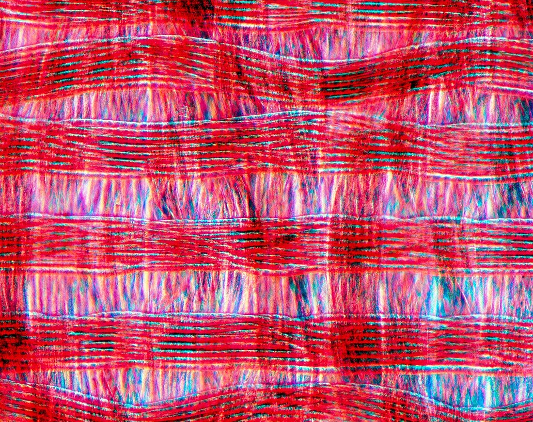 Light micrograph of polyamide in tissue