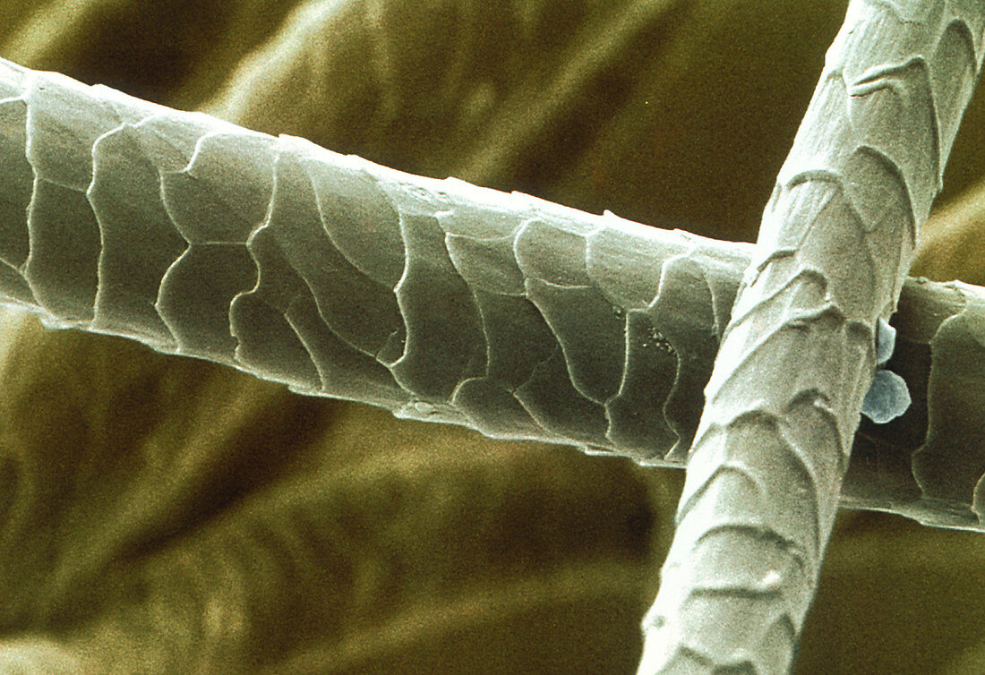 SEM of Aran wool fibres