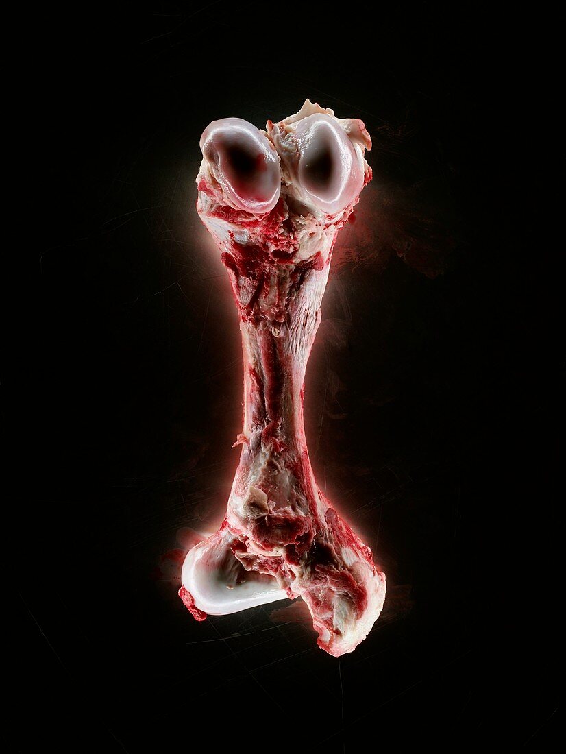Bloody bone