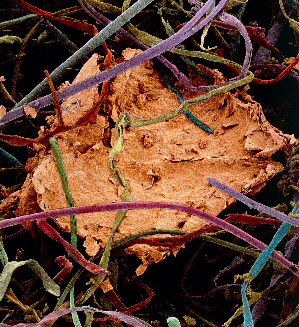 SEM of piece of human skin in household dust