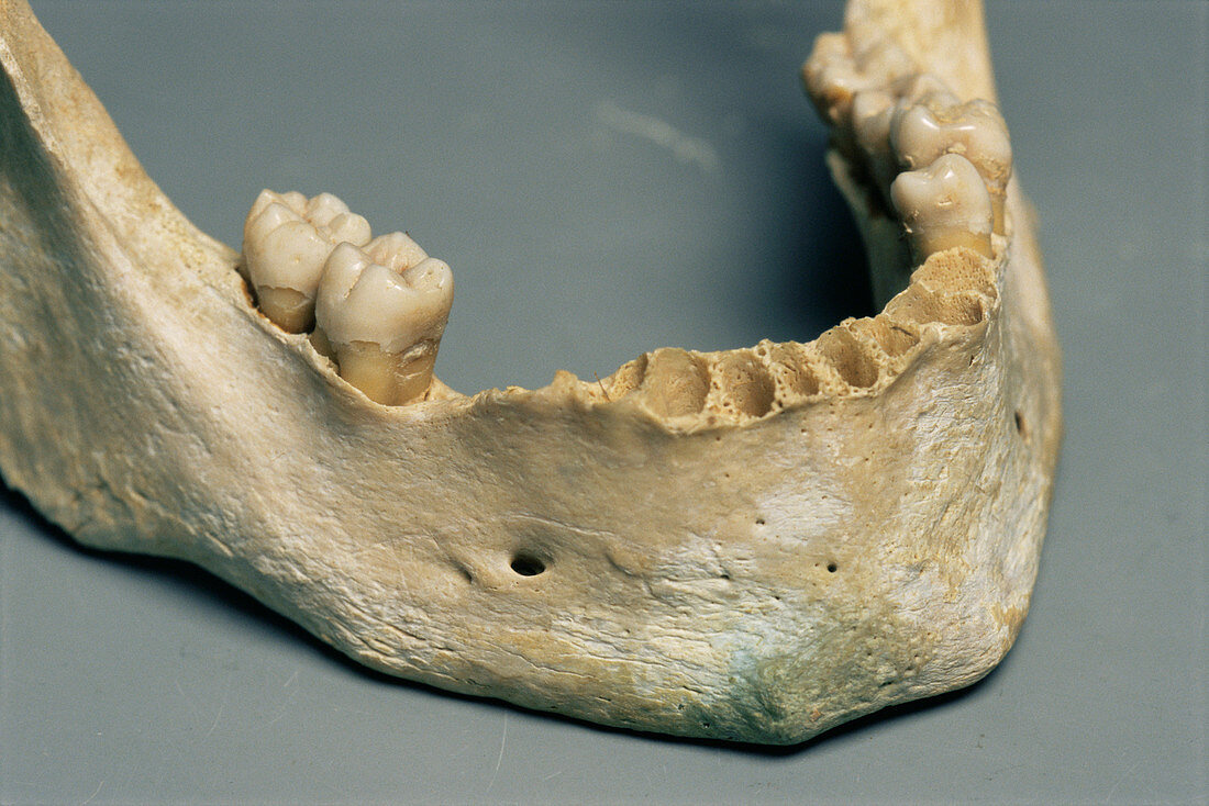 Teeth during forensic research