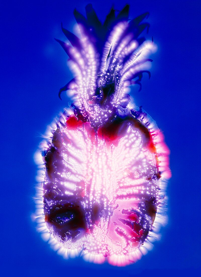 Kirlian photograph of a pineapple half