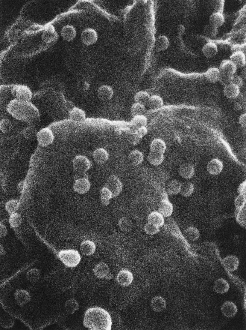 SEM of T-cell infected with AIDS virus
