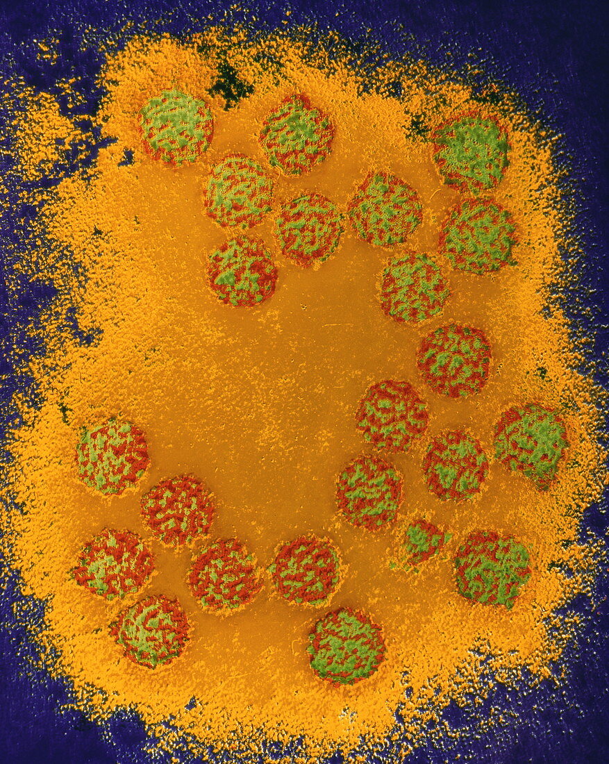 False-col TEM of papilloma virus particles